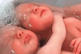 产妇顺产生下两个男娃，医生却道不是双胞胎，最后一语点醒梦中人图片
