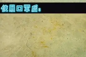 把用过的口罩放大1000倍，结果让人震惊！图片
