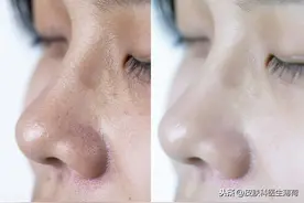 从妇女到女神，让皮肤变好的实用妙招图片