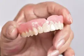 戴假牙便宜，但戴假牙的危害你知道吗？图片