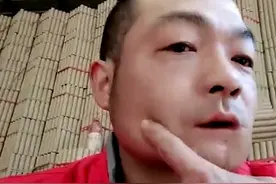 湖南小伙吃槟榔六年，险些被割舌头，它的危害到底有多大？图片