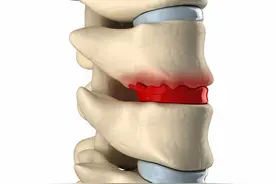 腰部经常疼痛难忍，引起你腰疼的几个原因，你都知道吗？图片
