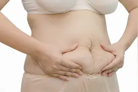 同样怀孕，为什么妊娠纹偏偏找上你？图片