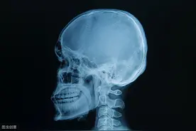 如何改变帕金森病患者的异动？图片