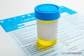 尿常规化验单中隐藏的20多个糖尿病健康小秘密，您真的知道吗？图片