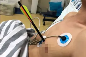 吓人！广西一男子被上膛弩箭“一箭穿心”，“凶器”离心脏仅1厘米图片