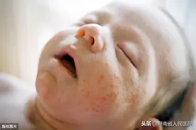 孩子过敏不能吃鸡蛋牛奶到底是真是假？真相来了！儿童过敏专家7条干货分享，这样喂养过敏宝宝也能吃出营养图片