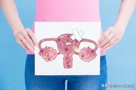 生完女人就上环？那男人为什么不结扎！关于结扎一定要知道3件事图片
