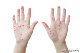 艾灸8句口诀，建议所有中医都记住！图片
