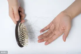 女性脱发和激素关系不大图片