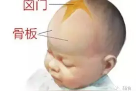 新手爸妈必知：关于宝宝囟门你知多少图片