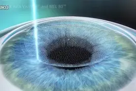 3D演示：飞秒激光手术原理，50秒了解~视频封面