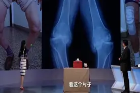 现场演示：自测腿部变形小妙招视频封面