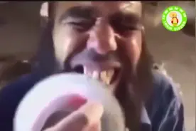 伊拉克神人用汽车抛光机打磨牙齿，看着牙都疼！视频封面