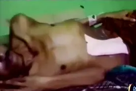印度一男子肚子越来越大，检查发现是藏在腹中36年之久的胎儿视频封面
