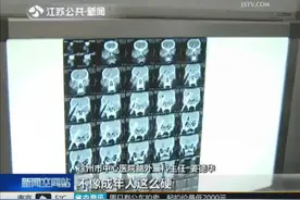 1岁女童螺丝刀插入大脑 医生提醒：提高警惕 莫让异物成凶手图片