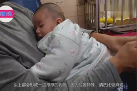 宝宝头上胎垢不好洗？教你一招，立马干净还放心视频封面