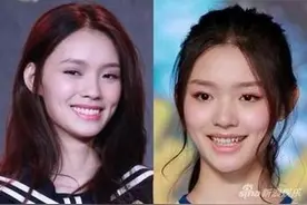 林允整牙模样大变 网友吐槽“好像看了个假的林允”图片