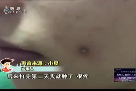19岁女孩想要酒窝，竟往脸上打钢钉，到医院检查，医生都不敢取视频封面
