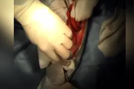 教学视频兽医真实录制，给骨折的狗腿打钢板视频封面