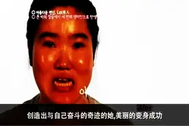 让我变美吧！韩国真人整形美容，巨颜丑女大变成美女图片