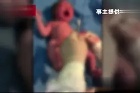 女子深夜挂急诊称“消化不良”，医生：你要生了！视频封面