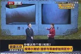 湿疹、荨麻疹你分得清吗？又该怎样去治疗？专家教怎么做视频封面