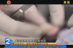 头长“犀牛角”，是种什么病？视频封面