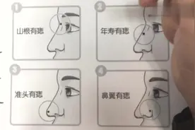 鼻子长痣解读运势，不同位置寓意不同，你有哪些视频封面