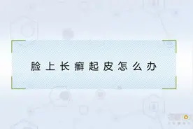 专家科普：脸上长癣起皮怎么办视频封面