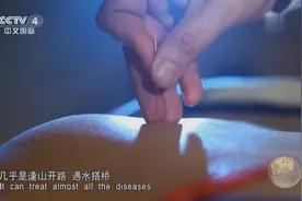 针灸为何能缓解疼痛？看完这个视频你就知道了视频封面