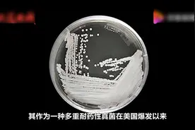 国内已有18例超级真菌确认感染视频封面