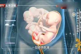 孕妈妈怀孕30周时，胎儿的脚却突然露出来，3胞胎情况十分危急视频封面
