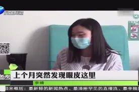 常用假睫毛 得了白癜风视频封面