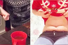厌食症女孩偷偷割自己的肚子，治疗一年后的样子让人认不出视频封面