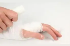 手骨折患者的饮食建议图片