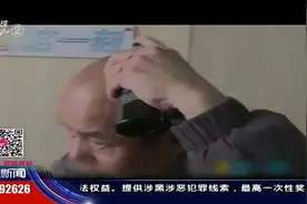 男子网购洗发水治脱发，洗了5个月后崩溃了！剩下几根头发也没了视频封面
