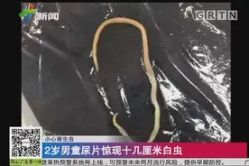 2岁男童尿片惊现十几厘米寄生白虫视频封面