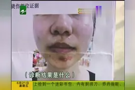 美容院里做脱毛，竟然又花了上千块治烫伤！视频封面