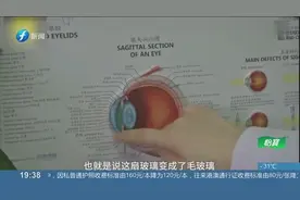 戴美瞳把眼睛戴“瞎了”？女孩长期戴美瞳，医院一查出事了视频封面