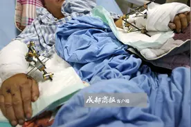 视频｜四川41岁硕士饲养员被大熊猫咬成重伤 左手掌几乎被咬掉图片