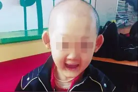 7岁男童没有牙齿，也没有汗腺，都是因为妈妈做了这件事！图片