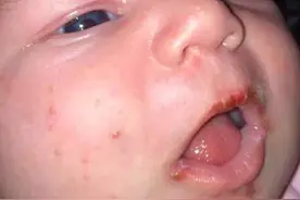 刚出生的宝宝竟因大人的亲吻而死亡！这10种情况千万别亲孩子！图片