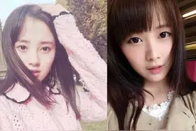 SNH48唐安琪伤势严重担心毁容 揭唐安琪与鞠婧祎关系如何图片