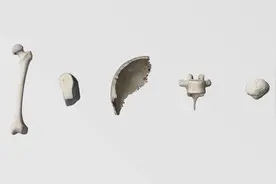 3D动画演示骨骼系统，女人有多少块骨头组成呢？视频封面