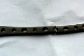 手术后体内金属接骨板断裂，谁负责？图片