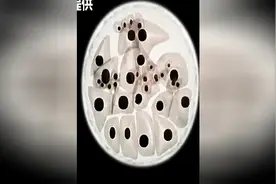 胚胎发育过程，宝宝在妈妈肚子里是如何长大的图片