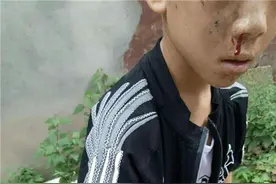 西昌泸山猴子4年伤人近500起 12岁少年玩具遭抢父子被猴群攻击图片