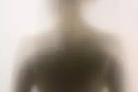 肺部磨玻璃结节是啥毛病图片