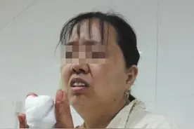 济南一女子骑车绊倒，中指被割断！还有人因此丧命！都是因为这种“夺命铁丝”图片